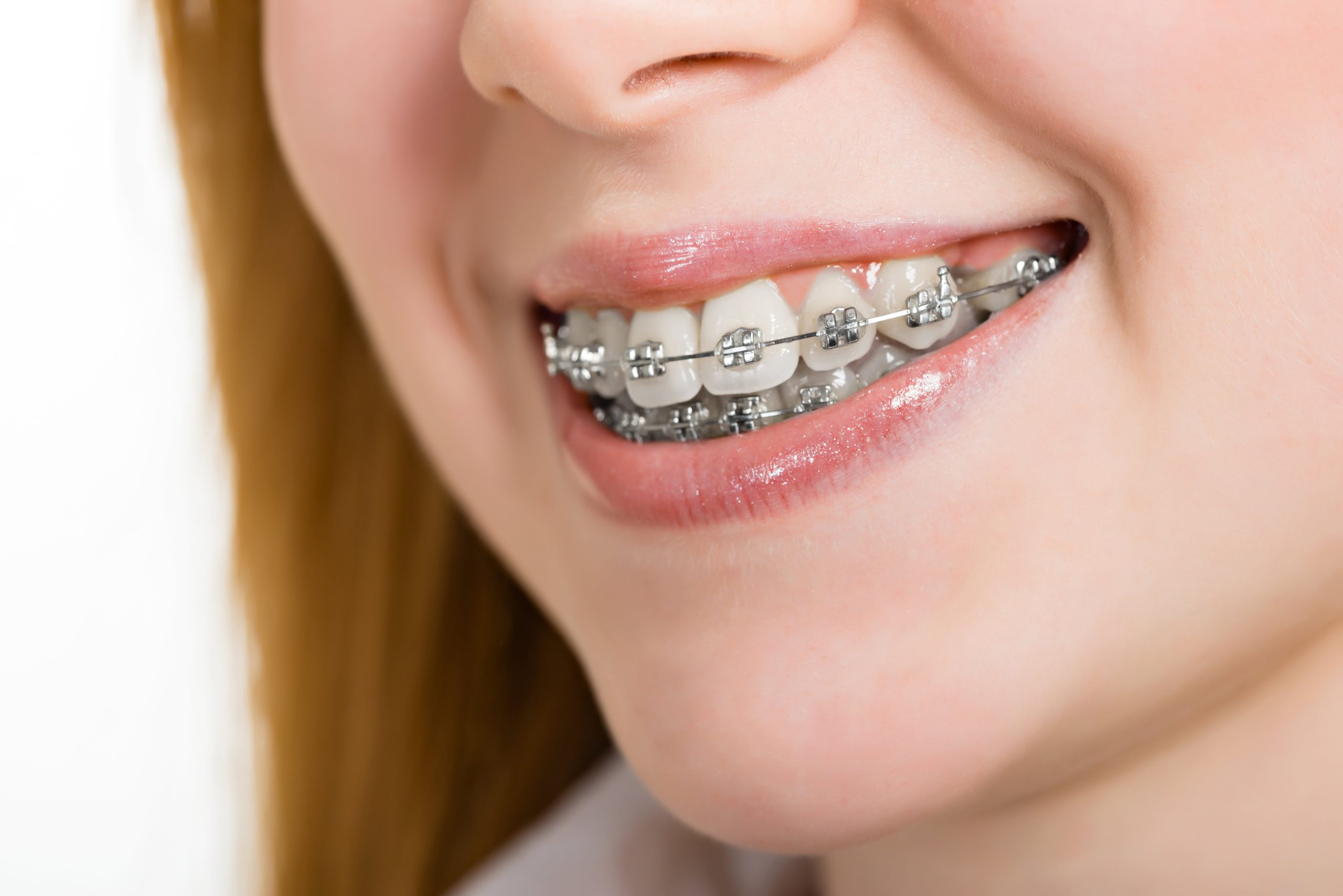 Can Cosmetic Dentistry Fix Crooked Teeth?